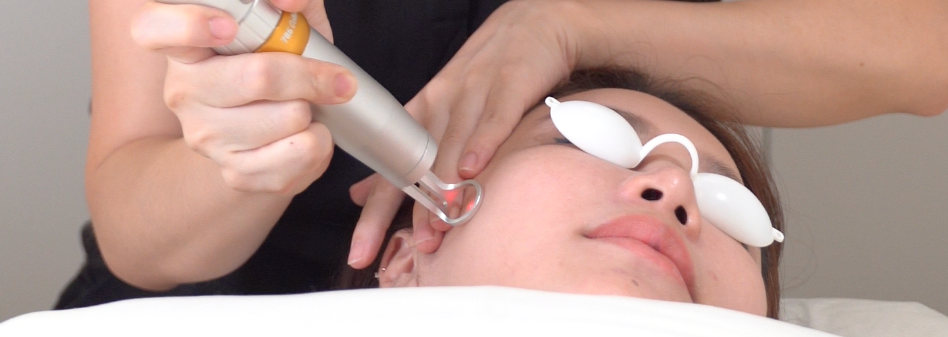 Acne Scar Treatment