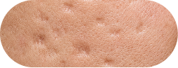 Boxcar scars