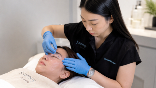Collagen Biostimulator Treatment