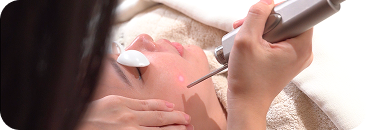Fotona 4D Laser Treatment