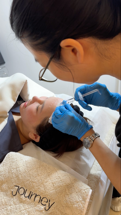 Skin Booster Treatment