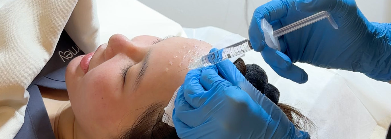 Skin Booster Treatment