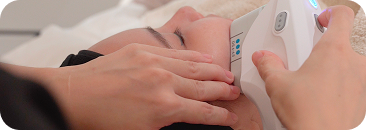 Ultherapy Prime Treatment